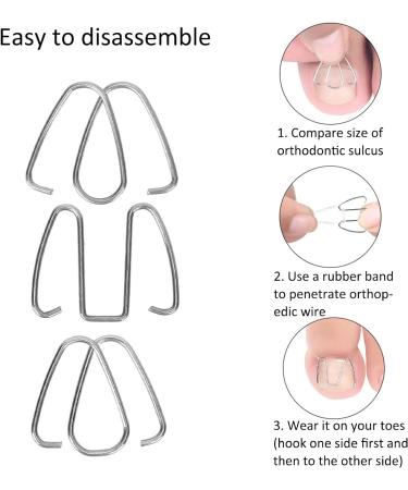 Ingrown Toenail Wire Fixer Ingrown Nail Corrector Iron Rubber Band for Pedicure Foot Care - Buy Online on GoSupps.com