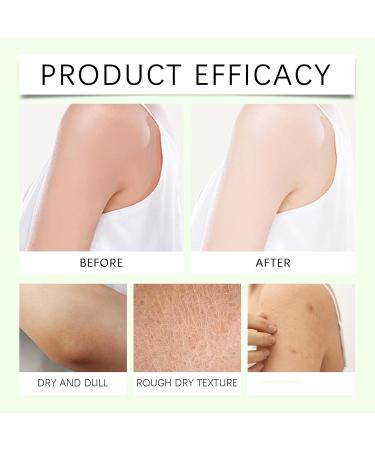 Neuropathy Cream Magnesium Body Butter Magnesium Cream Deeply Moisturizes Skin Keep Soft Smooth Lotion Suitable for All Skin Types (2PC 1) 2PC 4 Ounce (Pack of 1) - Buy Online on GoSupps.com