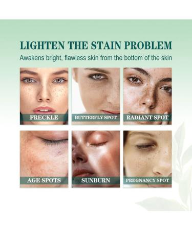 Buy Anti Spot Serum | Dark Spots Remover & Anti-Aging Face Care Serum for Brightening & Deep Wrinkle Reduction - International Shipping Available - Buy Online on GoSupps.com