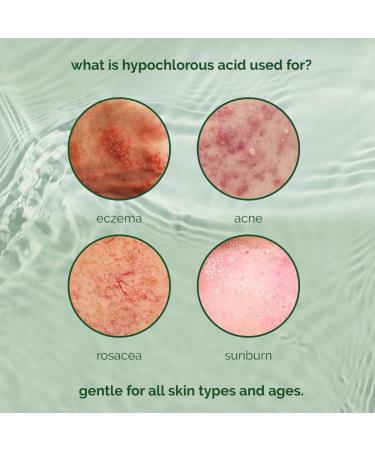 ALL-NATURAL Skin Refresh Anytime Toner | Hypochlorous Acid Spray for Sensitive Skin | Alcohol-Free Vegan Hydrating Care - Buy Online on GoSupps.com