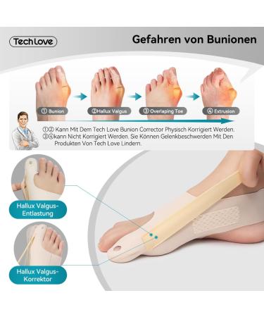Tech Love Hallux Valgus Socks Women's Bunion Relief Toe Separator with Non-Slip Heel Strap | Size L | Yoga Fabric | International Shipping - Buy Online on GoSupps.com