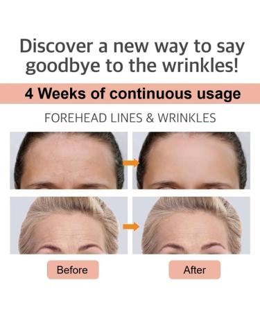 Forehead Wrinkle Patches - Reusable Anti-Aging Facial Treatment to Reduce Frown Lines Overnight for Women | International Shipping - Buy Online on GoSupps.com