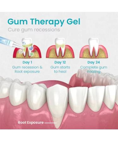 2024 Lovilds Gum Therapy Gel - Neslemy Gum Shield & Tooth Gel (1 & 2 pcs) | Best International Shipping - Buy Online on GoSupps.com
