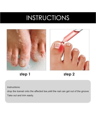 Ingrown Toenail & Fungal Nail Treatment Drops 10ML - Nail Care to Strengthen & Renew Damaged Nails - Buy Online on GoSupps.com