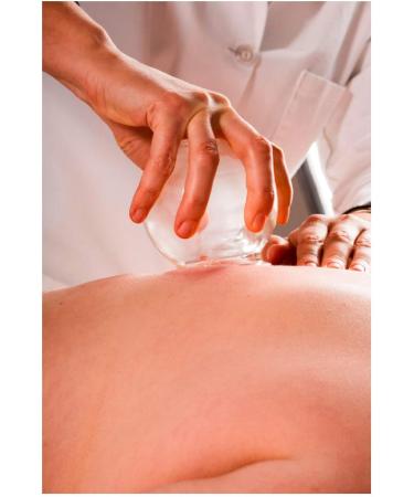 Buy Cupping Glass 5.5 cm - Medical & Fire Cupping Cups for Healing | International Shipping - Buy Online on GoSupps.com