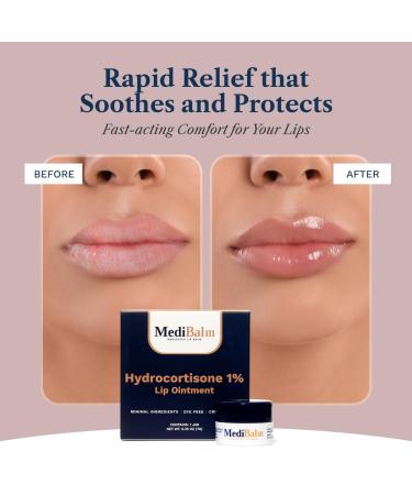 MediBalm 1% Hydrocortisone Lip Balm Petrolatum-Free Relief for Chapped Dry or Irritated Lips due to Accutane Isotretinoin associated Cheilitis Weather Damage and more - Unflavored - Buy Online on GoSupps.com