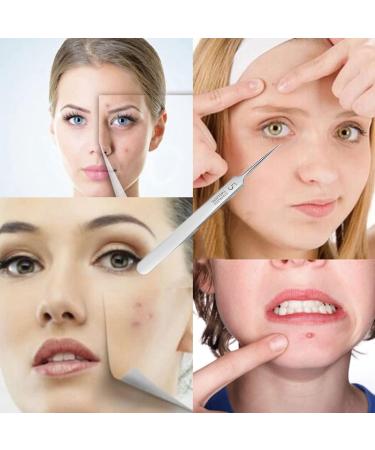Blackhead Tweezers Precision Stainless Steel Curved Hook for Acne Pimples Comedones Stains or Splinter Removal and Treatment of Ingrown Hair - Buy Online on GoSupps.com