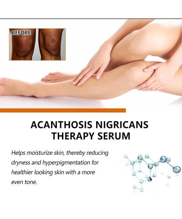 LONGLUAN Fivfivgo Advanced Skin Brightening Serum - Melanosis & Dark Spots Remover - Buy Online on GoSupps.com