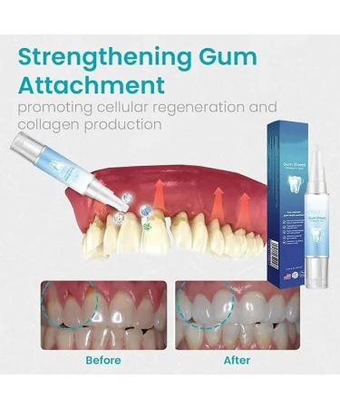 Neslemy Gum Shield Therapy Gel New Gum Repair Treatment Gel Teeth Whitening Essence Pen Deeply Cleaning Gums Enhances Overall Gum Health(3PCS) - Buy Online on GoSupps.com