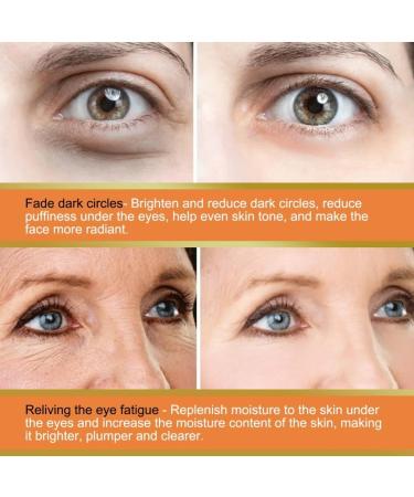 Vitamin C Eye Cream Stick Moisturize Eye Cream Stick Eye Brightening Stick Reduce Eye Bags Firm Skin (3PC) - Buy Online on GoSupps.com