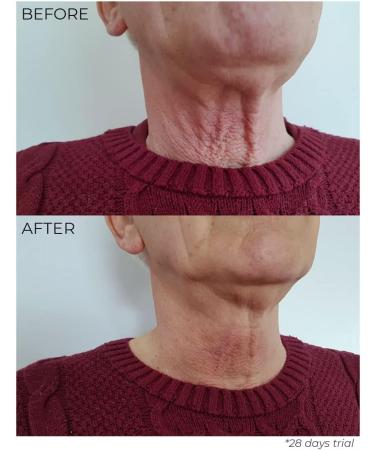  Nourish London TSL Tighten Sculpt & Lift Neck Elixir - 30ml NEW - Buy Online on GoSupps.com