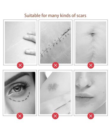Scar Removal Gel 20g - Fast Penetration for Delicate Skin Repair & Growth - Daily Use Head Massage Cream - Buy Online on GoSupps.com