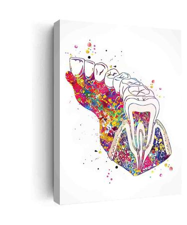 DAVUD Home Decor Bedroom Molar Tooth Section Diagram Watercolor Print Human Teeth Dental Office Clinic Decor Art Dentistry Dentist Gift Dental Hygienist- 16in x24 in-Ready to hang