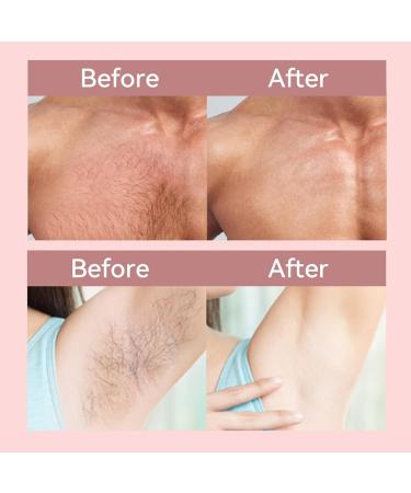 VBKITW Fleece Hair Removal Strips - 10 Pieces for Wax & Sugar Paste 9x18.5cm Face & Body Epilation - Buy Online on GoSupps.com