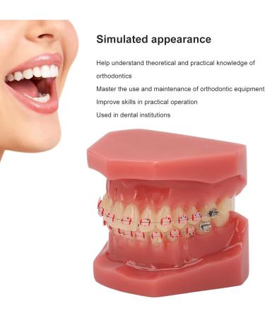 Orthodontic Tooth Model for Teaching - Metal Wires & Holder | Best Simulation for Learning - Buy Online on GoSupps.com