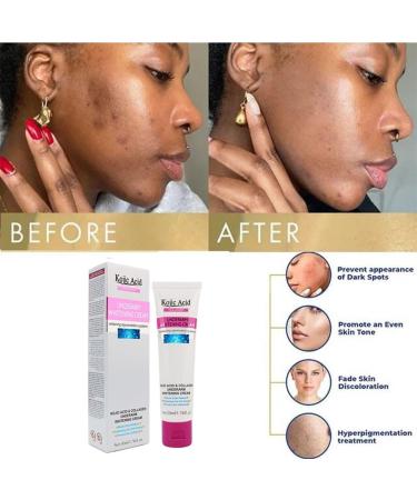 Kojic Acid Skin Lightening Cream Underarm Cream Intimate Area Dark Spot Corrector Whitening Cream for Body Underarms Armpit Knees Legs and Inner Thigh Cream for Acanthosis Nigricans Non-Greasy - Buy Online on GoSupps.com