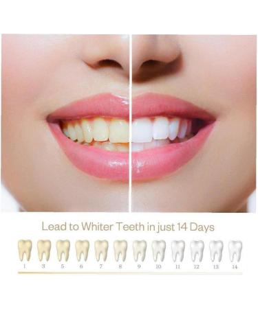 1pc Teeth Whitening Pen Tooth Whitening Gel Tooth Bleach Gel Whitener Remove Stains Toothpaste Pen Oral Hygene Dental Care - Buy Online on GoSupps.com