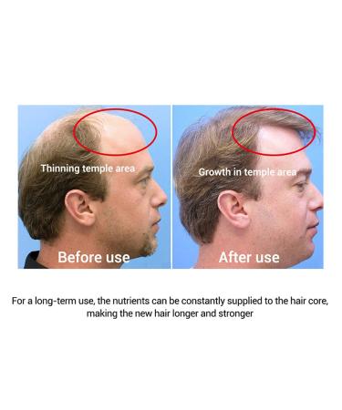 Hair Growth Serum - Fast Regrowth & Anti Hair Loss Oil for Dense Beautiful Hair | International Shipping - Buy Online on GoSupps.com