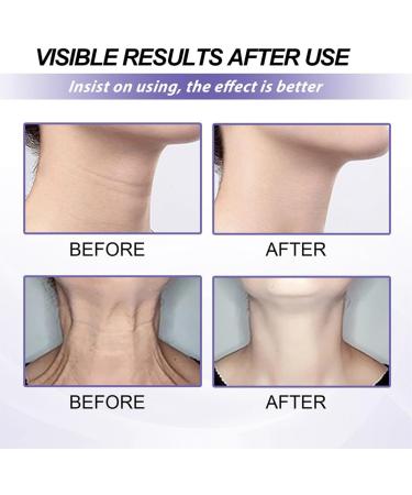Neck Firming Cream Neck Skin Tightening Neck Cream for Sagging & Tighten Anti Ageing Cream for Women Anti Wrinkle Cream for Neck Neck Lift Tighten and Lift Neck Cream Tightening Moisturizer for Neck - Buy Online on GoSupps.com