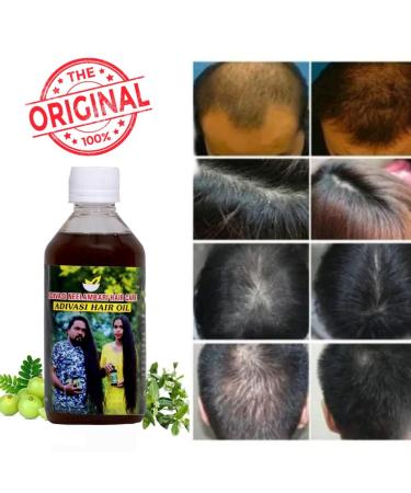 ADIVASI HERBAL Nilambari Hair Oil - Original Ayurvedic Hair Care for Strong Healthy Hair & Scalp Nourishment | International Shipping - Buy Online on GoSupps.com