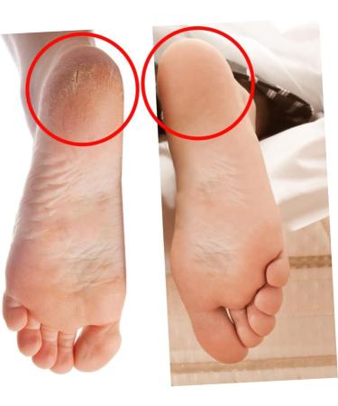 minkissy 2 Pairs Lotion Socks Shoe Mat Beach Socks Moisturizing Socks Breathable Socks Foot Protectors for Feet Gel Heel Socks Silicone Socks Care Heel Cover Plantar Insoles - Buy Online on GoSupps.com