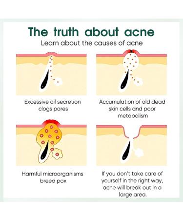 Anti Acne Face Cream Tea Tree Acne Cream for Acne Treatment & Spot Treatment Spot Cream Soothing Ance Gel for Blemishes Blackhead Remover Acne Moisturiser Reduces Redness Oil Control - Buy Online on GoSupps.com