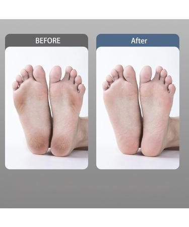 Nuyhadds Electric Foot Grinder Small Foot Sander Electric Callus Remover | Fully Automatic Foot File Feet Pedicure Tools Powerful Foot Callus Remover Tool for Men Women Black - Buy Online on GoSupps.com