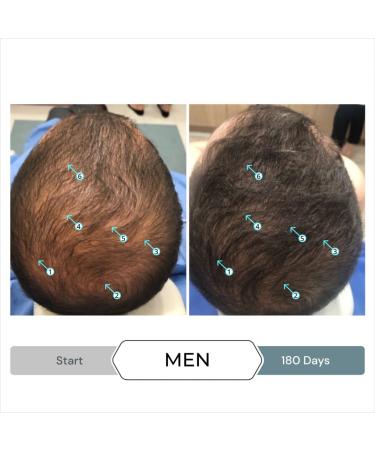 Revita.SOD Hair Growth Supplement by DS Laboratories - Fuller Thicker Stronger Hair, Combat Hair Loss & Thinning Due to Stress, Reduce Balding & Shedding - 30 Day Supply - Buy Online on GoSupps.com