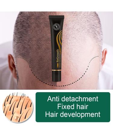 Hocossy Regrowth Organic Hair Serum Roller Set - Scalp Intense Hair Growth Treatment for Men & Women 20ml 3PCs - Natural Hair Care Solution - Buy Online on GoSupps.com