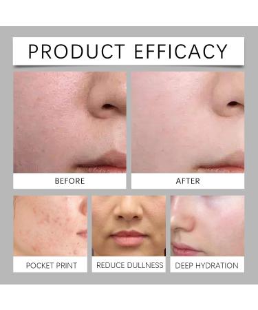 Aloe Vera Hydrating Toner - Daily Face Moisturizer For Deep Nourishment Reduces Dryness & Tightness Soothes Skin(3PCS) - Buy Online on GoSupps.com