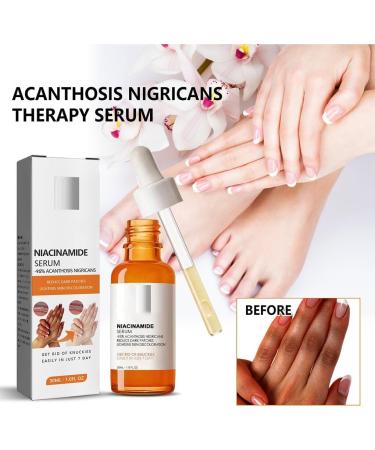 Allayu Women Skin Repair Serum Elbow Knee Armpit Nourishing Moisturizing Hydrating Whitening Essence Female Anti-wrinkle - Buy Online on GoSupps.com
