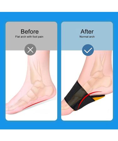 2 Pairs Arch Support Pads - Cushioning for Plantar Fasciitis Flat Feet & Heel Spurs - Comfort & Pain Relief Sleeves - Buy Online on GoSupps.com