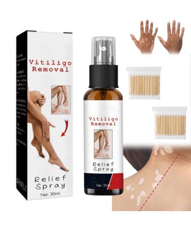 Alkyne Vitiligo Removal Relief Spray Vitiligoremoval Relief Spray Vitiligo Skin Repair Spray Vitiligo Treatment Spray Vitiligo Care Spray for Skin Care (1pc)