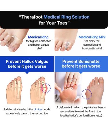 Aider Therafoot Mini Bunion Corrector - Soft Gel Pinky Toe Separator & Pain Relief - 1 Set for Left & Right Feet - Buy Online on GoSupps.com