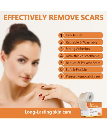 Medical Grade Silicone Scar Tape Roll - Postpartum Belly Band for Scars, Keloids, Burns & Thyroid - 1.6 x 60 | Effective Scars Removal Solution - Buy Online on GoSupps.com