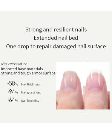 Cuticle Oil for Nails 7.5ml Nail Oil Nail Cuticle Oil with Jojoba Oil & Lavender Extract Nails Oil for Damage Nails Moisturizes Strengthen Nail Growth & Nail Repair Prevents Hangnails Cracked - Buy Online on GoSupps.com