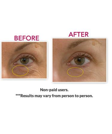 Magic Anti-Eye bag Anti-Dark Circle Anti-Puffy Eyes Corrective Eye Cream w/Eyeseryl Matrixyl 3000 Argireline Apple Stem Cell 2 Count (Pack of 1) - Buy Online on GoSupps.com