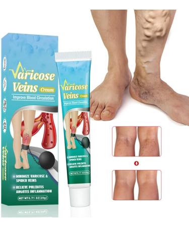 Varicose Veins Cream Repairing Cream for Varicose Veins Spider Veins Treatment Cream Anti-Varicose Veins Cream Legs Ointment for Varicose Veins Relieves Tired Legs 20g - Buy Online on GoSupps.com