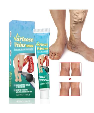 Buy Lichengtai Varicose Veins Cream - 3PCs Spider Vein Treatment for Clearer Legs | Fast International Shipping - Buy Online on GoSupps.com