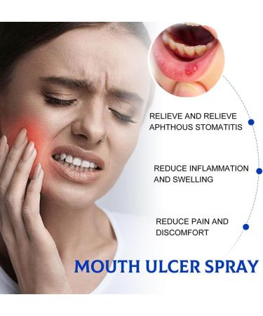 Mouth Ulcer Spray - 30ml Antibacterial Relief for Mouth Wounds & Soothing Care - Buy Online on GoSupps.com