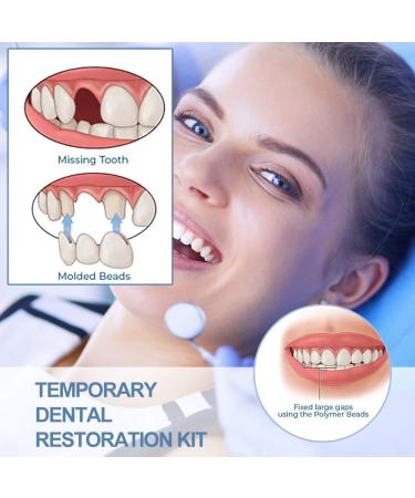 Premium Temporary Denture Set - DIY Heat Fit Beads for Quick Dental Restoration | Prosthesis & Repair Solutions - Buy Online on GoSupps.com