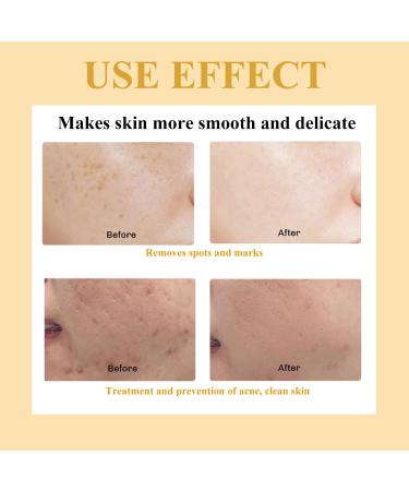 Turmeric Kojic Acid Cleansing Pads - Brightening Face Scrub for Dark Spots | 50pcs Gentle & Safe Skin Balance - Buy Online on GoSupps.com