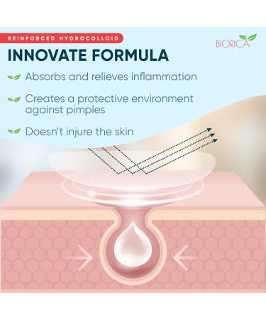Acne Pimple Patches - 216 Hydrocolloid Zit Patches for All Skin Types - Invisible Healing Treatment - Buy Online on GoSupps.com