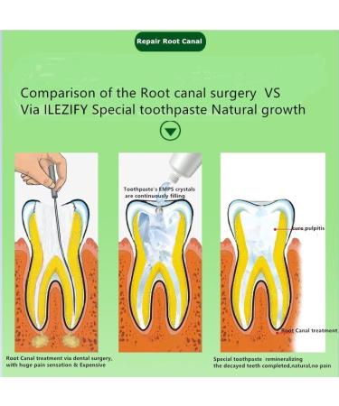 Specialty Gum Toothpaste for Root Canal Treatment | Nanohydroxyapatite Gum Repair | Relieves Pulpitis & Periodontitis Pain | Prevent Root Fracture | 3.52 Oz Spearmint - Buy Online on GoSupps.com