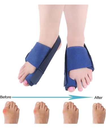Buy Bale Toe Correction Tools - Pain Relief for Hammer Toe & Hallux Valgus - Smooth Iron for Foot Care - Buy Online on GoSupps.com