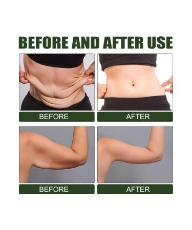 Avocado Body Cream Scrub | Exfoliating Anti-Cellulite Scrub for Women | Gentle & Non-Sticky Exfoliation - Buy Online on GoSupps.com