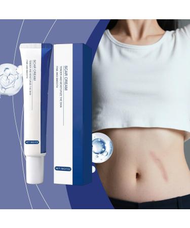 Burn Scar Cream Burn Repair Product - New Soothing Scar Cream - For Men and Women Knees Burns Keloids Wound Recovery - Buy Online on GoSupps.com