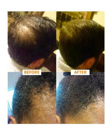Nor1 Keratin Hair Building Fibers 25g Light Blonde - Hair Fiber Filler for Thinning Hair - Men and Women Concealer - Fuller Hair in Seconds - Buy Online on GoSupps.com