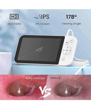 HSRG 5-Inch Portable LCD Photo Camera & Ear Cleaner 1080p HD 3.9mm Ear Wax Removal Tool Video Recording & Photo Storage International Shipping Available - Buy Online on GoSupps.com