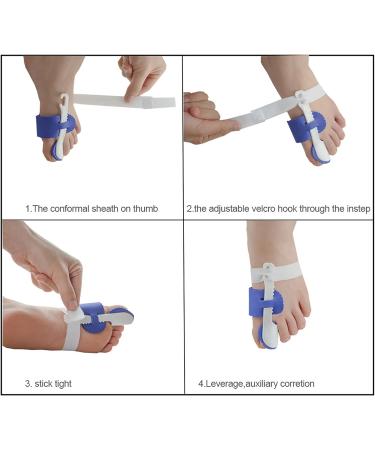 ALINZO Metatarsal Pads Big Toe Separator for Bunion and Hallux Valgus - Silicone Bunion Corrector & Toe Alignment Gel Orthotics - Buy Online on GoSupps.com
